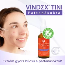 WTN VINDEX TINI BŐRKONDÍCIONÁLÓ CSEPP 30 ML PATTANÁSOKRA ÉS FELÜLETI