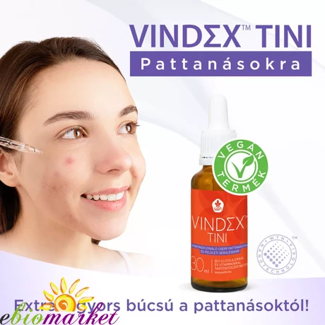 WTN VINDEX TINI BŐRKONDÍCIONÁLÓ CSEPP 30 ML PATTANÁSOKRA ÉS FELÜLETI